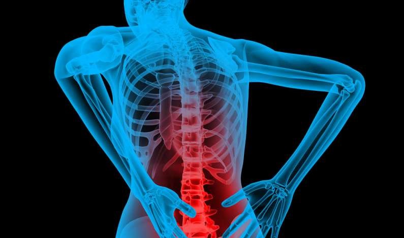 Back-Pain-knowexact