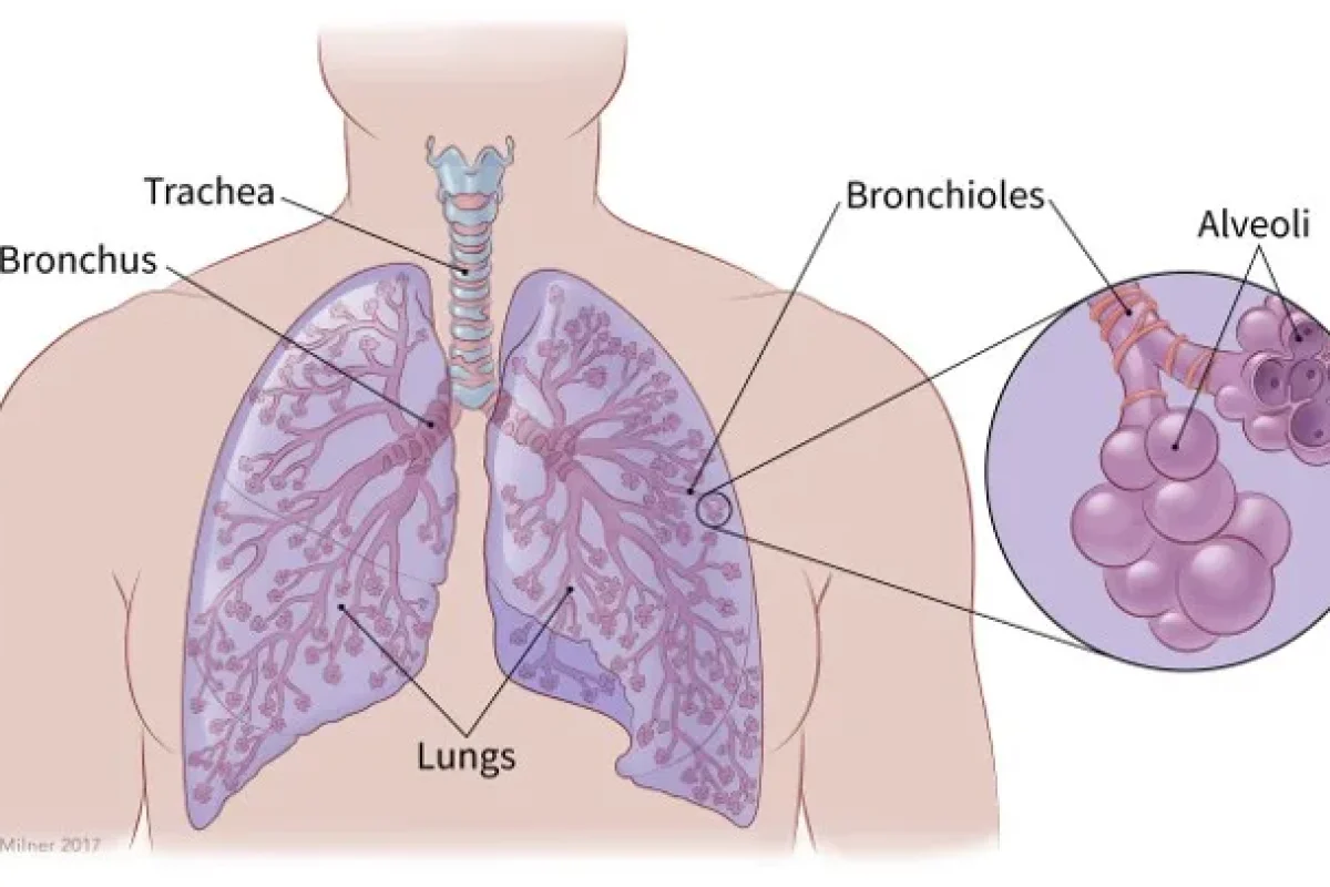 lung-cancer-knowexact